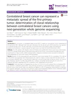 Contralateral breast cancer can represent a metastatic spread of the first primary tumor: determination of clonal relationship between contralateral breast cancers using next-generation whole genome sequencing